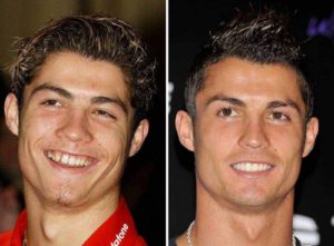 CristianoRonaldoBeforeAfter