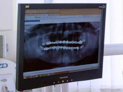 Panoráma röntgen a pontos diagnózisért